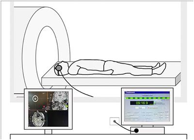 Low Intensity Focused Ultrasound for Non-invasive and Reversible Deep Brain Neuromodulation—A Paradigm Shift in Psychiatric Research